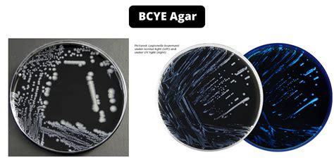 bcye agar selective or differential